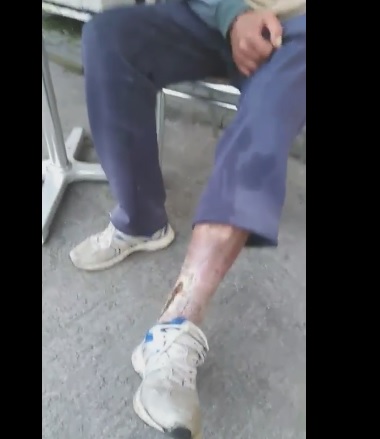 Luca Cornel (Manzu) Ludus