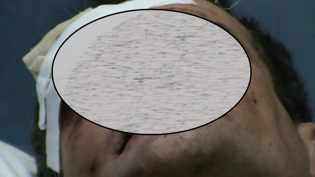 Câmpia Turzii – și-a bătut tovarășul de pahar până i-a crăpat capul