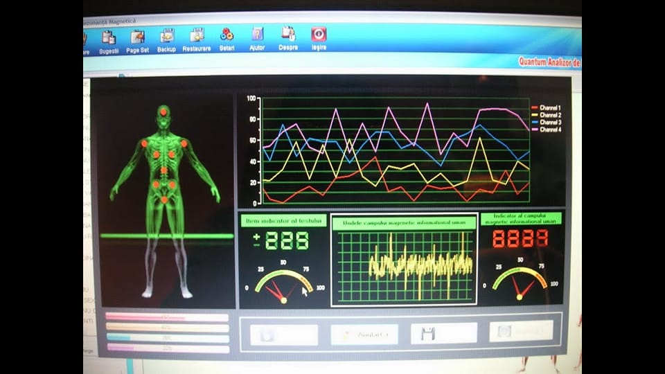 Dr. Lehel Csergo: „Mă întreb pe ce bază sunt lăsate să funcționeze cabinetele de biorezonanță, că pe bază științifică, sigur nu!”
